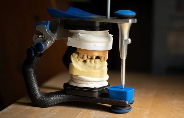 tooth-replacement-3532982_640